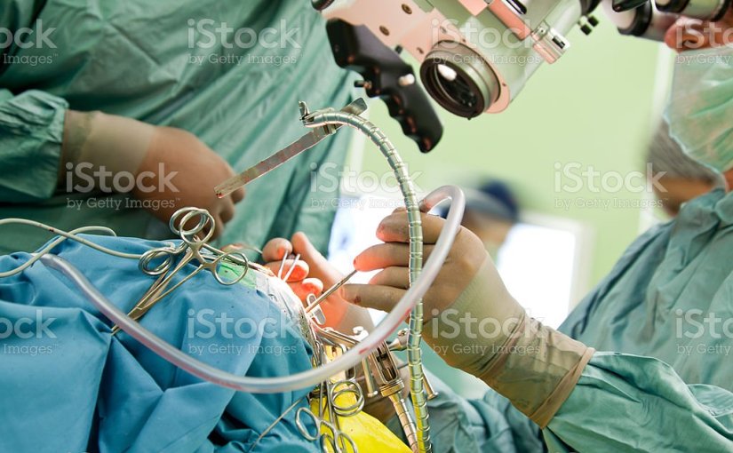 Neurosurgery